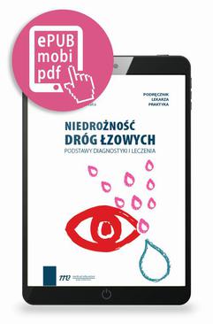 ebook Niedrożność dróg łzowych