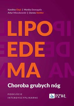 ebook Lipoedema