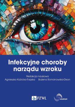 ebook Infekcyjne choroby narządu wzroku