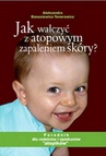 ebook Jak walczyć z atopowym zapaleniem skóry - Aleksandra Banasiewicz-Tenerowicz