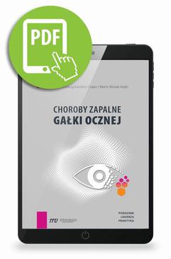 ebook Choroby zapalne gałki ocznej - poradnik lekarza praktyka