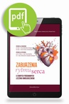 ebook Zaburzenia rytmu serca u chorych poddawanych leczeniu onkologicznemu - Radosław Grabysa,Tomasz Kubiatowski,Ewa Lewicka,Aleksandra Lizewska-Springer