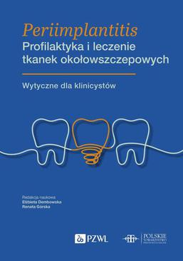 ebook Periimplantitis Profilaktyka i leczenie tkanek okołowszczepowych