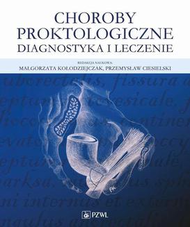 ebook Choroby proktologiczne