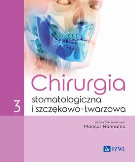 ebook Chirurgia stomatologiczna i szczękowo-twarzowa Tom 3